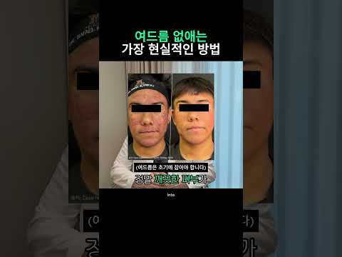 이소티논