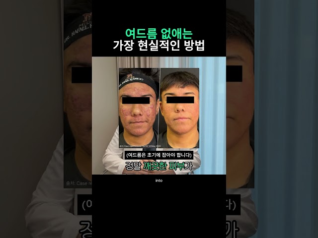 이소티논