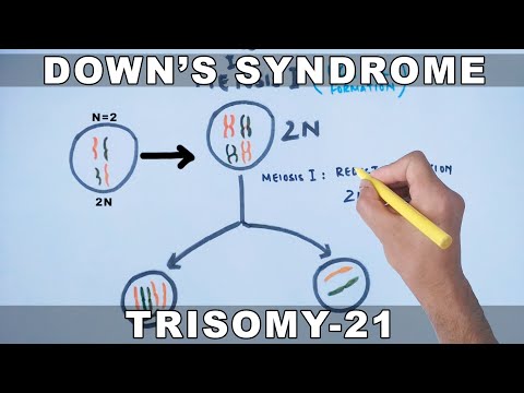 Down's Syndrome