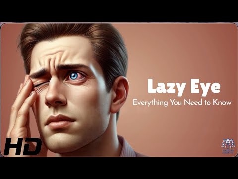 Lazy Eye in Adults: Is It Ever Too Late to Treat?