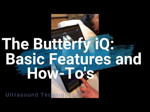 image-Can you use butterfly ultrasound without subscription?