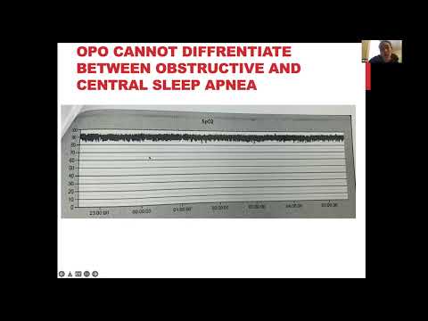 2022 02 01 - CWRU SMGR: Dr. Mirna Ayache - Hypoxemia on Overnight Pulse Ox: Is it Sleep Apnea or?