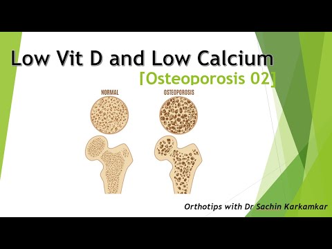 Low Vit D and Low Calcium