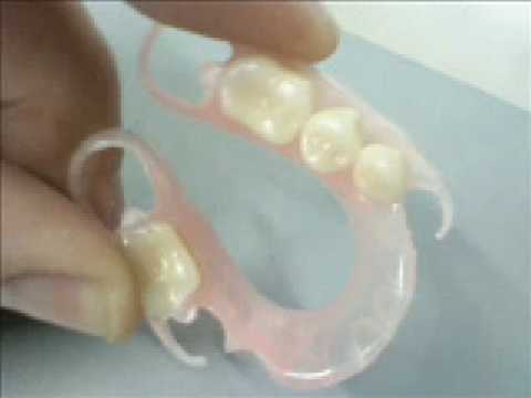 PPFLEX - MARCELO NUNES