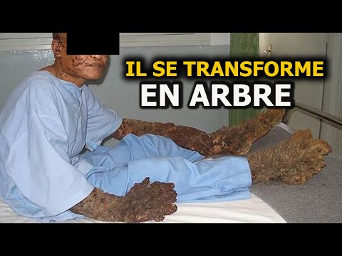 HE TURNS INTO A TREE... MYSTICAL STORY - DMG TV