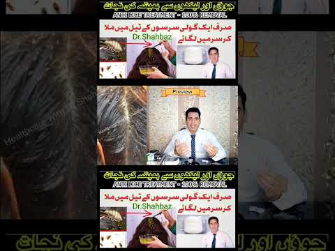 Juon or Likhon Ka Khatma | Juon or Likhon ka ilaj | Juon or Likhon se Nijat | Head Lice Removal