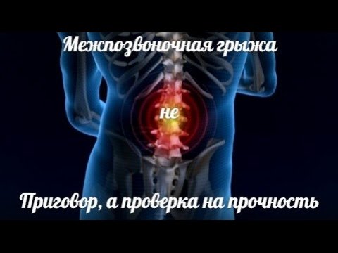 Степени сколиоза позвоночника у взрослых Корсеты для коррекции фигуры осанки