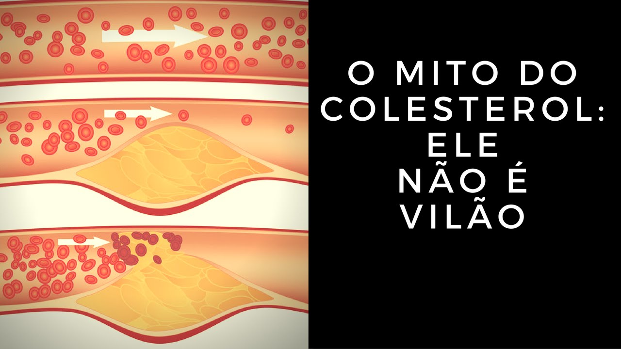 O Mito do Colesterol: Ele Não É Vilão