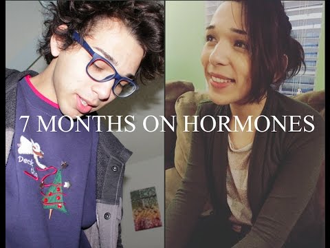 7 MONTHS ON HRT | MTF Transition | Update
