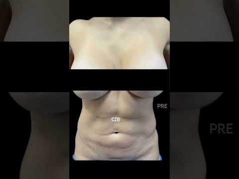 video esgQPVwlXkM