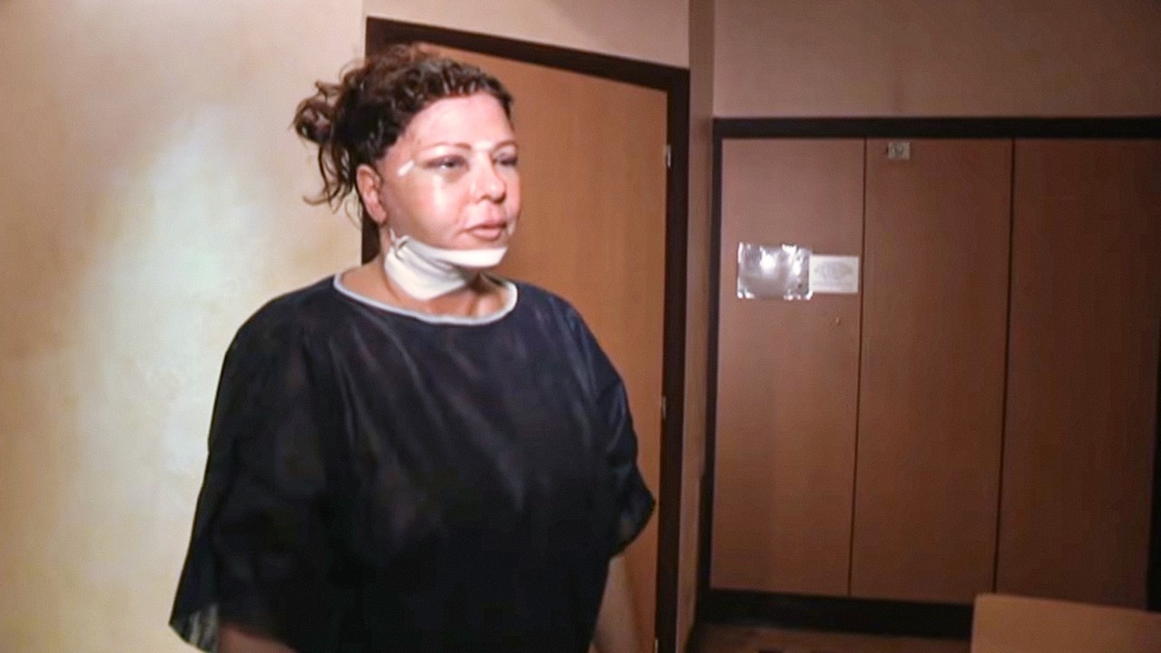 Chirurgie Esthétique : Jusqu'où iront-ils | Beauté à tout prix