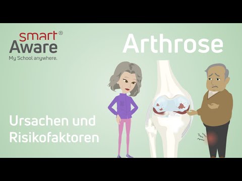 Arthrose: Ursachen und Risikofaktoren I Fachfortbildungen in der Pflege | smartAware