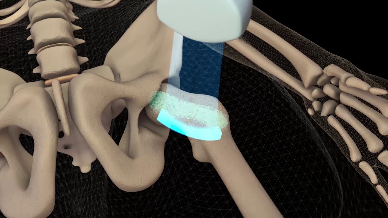 Bone Health monitoring throughout life