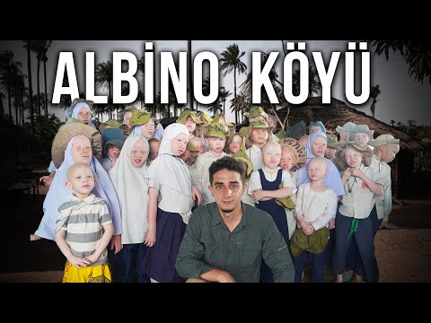 Görüldüğü Yerde Öldürülen "Beyaz Afrikalı Albinoların" Gizli Köyünde 1 Gün Geçirmek!