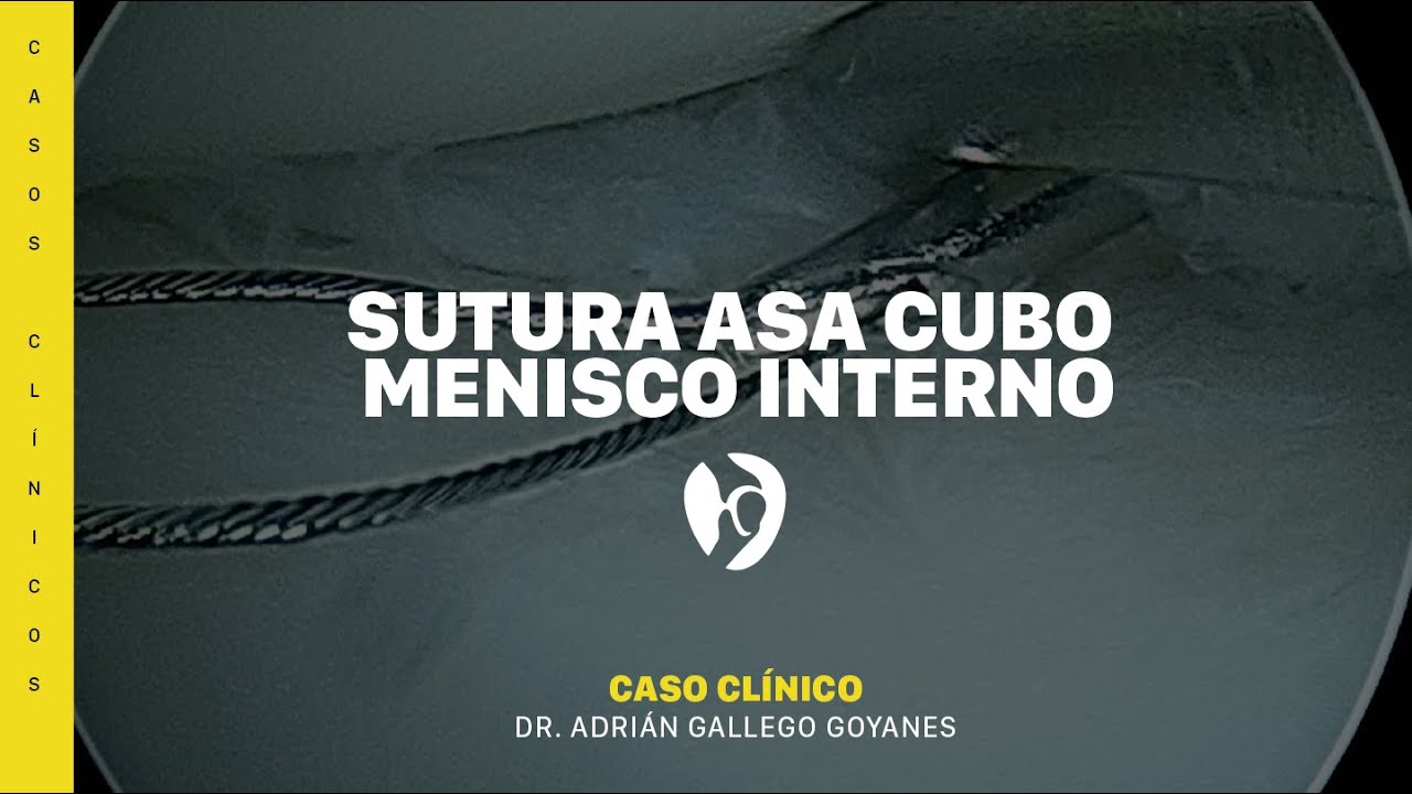 Adrián Gallego Goyanes-31