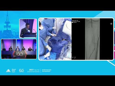 LIVE CASE PRESENTATION #3 MULTI LEVEL COMPLEX - Prakash Krishnan, MD