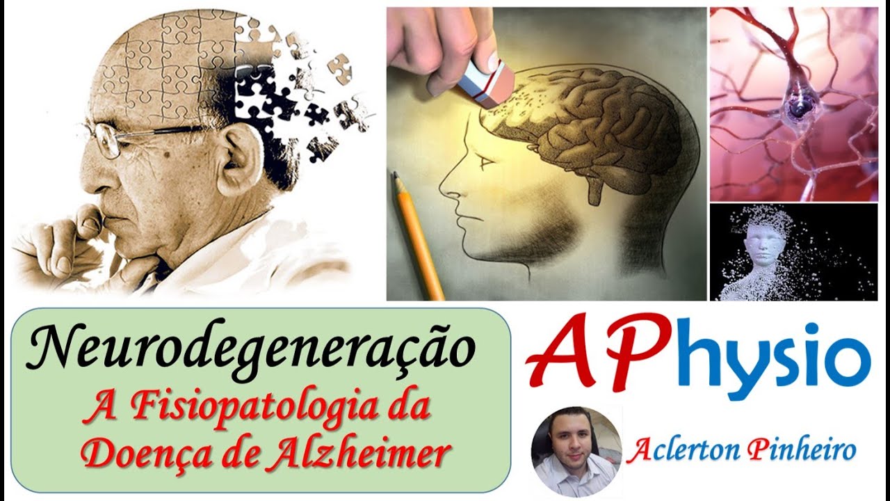 Neurodegeneração - A Fisiopatologia da Doença de Alzheimer