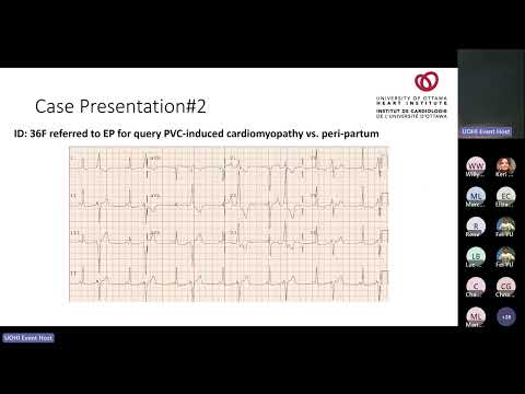 Frequent Ventricular Ectopy: Defining Outcomes, When, and How to Treat with Michael Thibert, MD