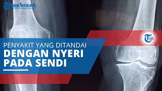 Rematik, Penyakit yang Ditandai dengan Nyeri Sendi yang Disebut Juga Rheumatoid Arthritis