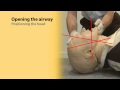 Basic Airway Management 1