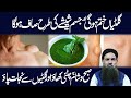 Jism Mein Giltiyon Ka Ilaj Giltiyon Ka Elaj Gilti Ka Ilaj Dr Sharafat Ali