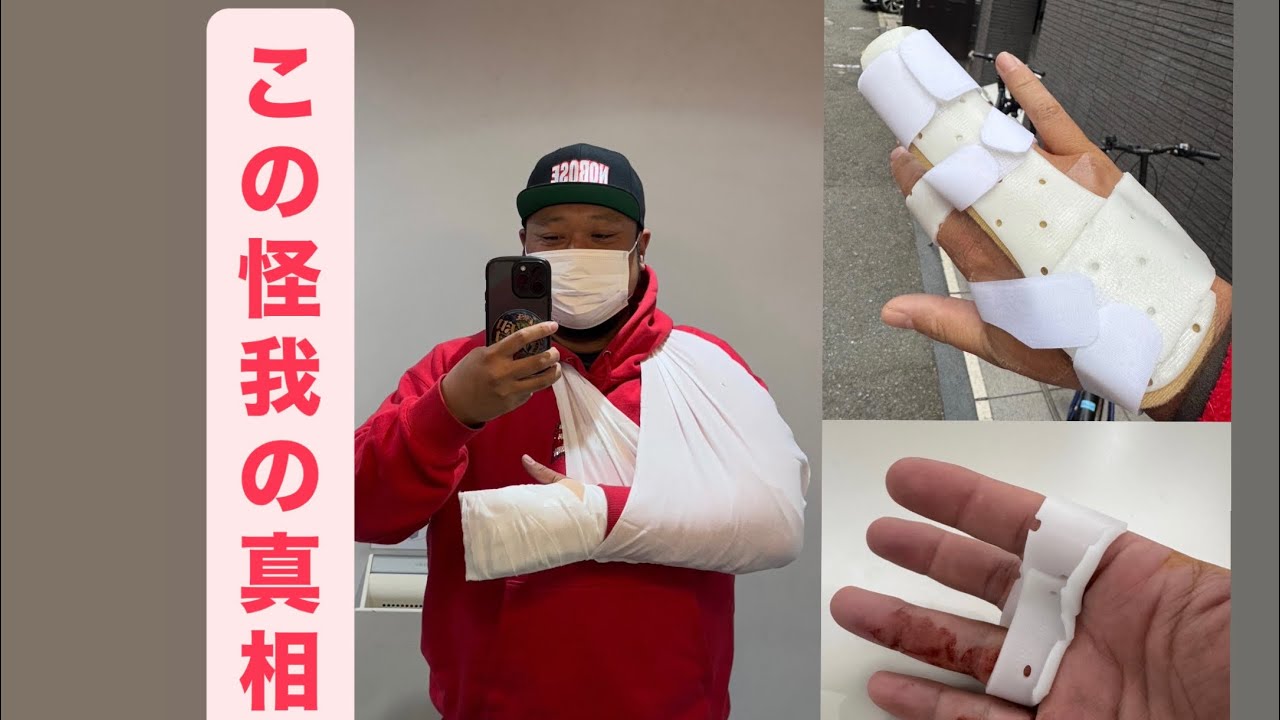 怪我しました！　#NOBOSE #怪我