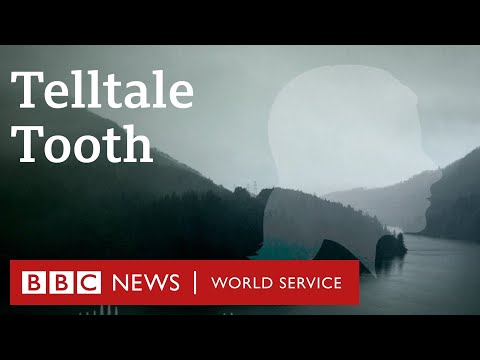 The Isdal Woman's telltale tooth, Death in Ice Valley, Episode 4 - BBC World Service