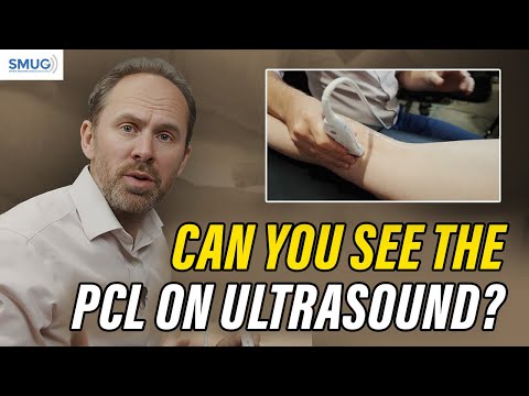 PCL Ultrasound Imaging: How to Identify and Assess the Posterior Cruciate Ligament