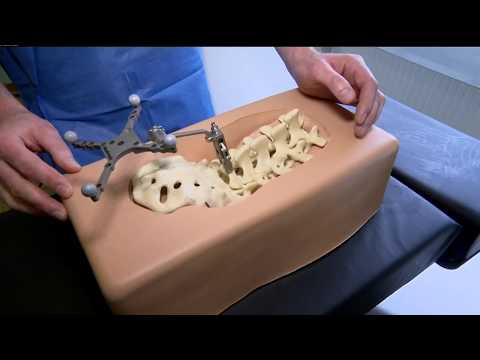 Deformáló artrózis diagnosztikai kezelés