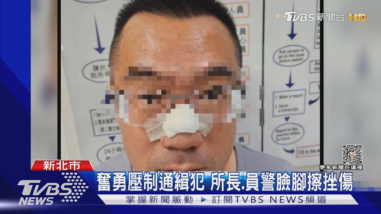 怕抓去關!騎士拒檢衝撞 警壓制撞傷鼻樑