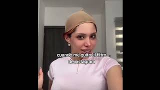 Yeri Mua el antes y después de sus cirugías!  kheee!