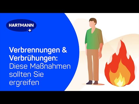 Erste Hilfe bei Verbrennungen & Verbrühungen: Diese Maßnahmen sollten Sie sofort ergreifen