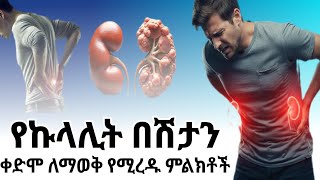 የኩላሊት በሽታን ቀድሞ ለማወቅ የሚረዱ 5 ምልክቶች