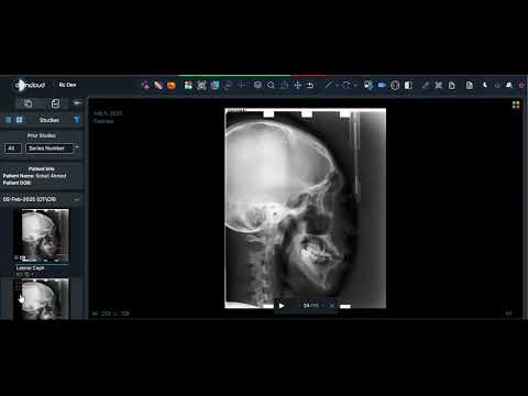 DCMCloud - Cephalometric Analysis | AI-Powered Dental Imaging
