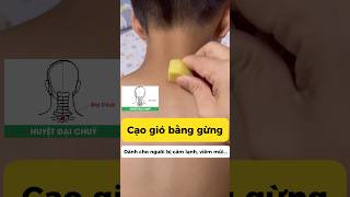 Download lagu Cạo gió bằng Gừng. Dành cho người bị cảm lạnh, viêm mũi... #yhct #dongy #songkhoe #camlanh #camcum mp3