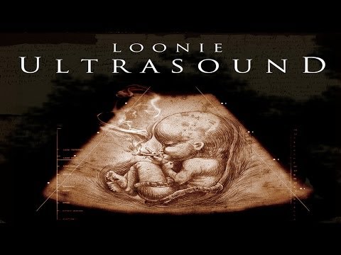 Loonie- Pilosopo (feat. Smugglaz)