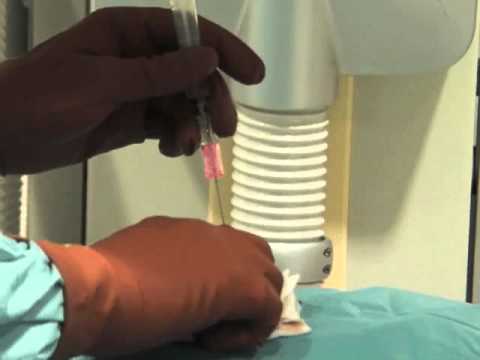 MIC* G Introducer Kit - Dr. Laasch Radiologic Placement