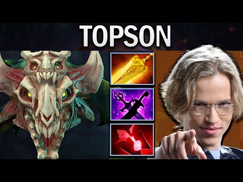 Viper Dota 2 Gameplay Old G.Topson with Radiance - Bloodstone