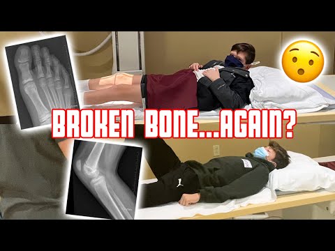 TWO X-RAYS IN ONE DAY | TWO POSSIBLE BROKEN BONES | TWO SEPARATE KIDS