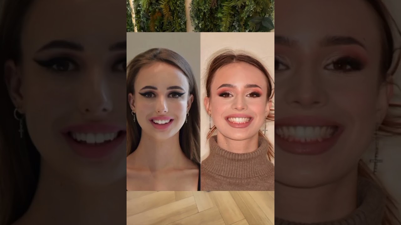 Lara mesél az arc- és mosoly átalakulásáról