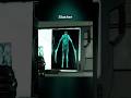 How Necromorphs Look Through X-Ray Imaging 💀 Dead Space Remake