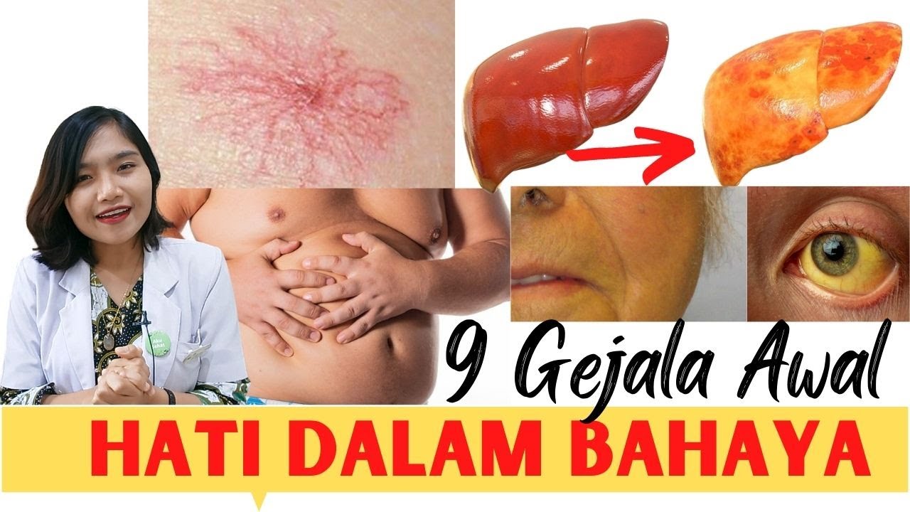9 GEJALA SAKIT HATI BERLEMAK ! SERING DI KIRA ASAM LAMBUNG !  | FATTY LIVER
