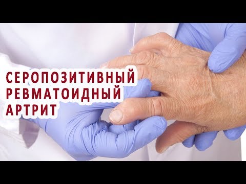 Сустав колена стерся Препараты для лечения суставов спортсменам