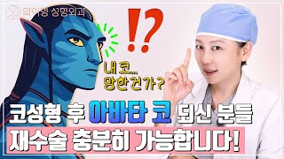 코 성형 후 아바타 코가 되었는데 코재수술이 가능할까요? l 와이영성형외과 #코성형 #코수술 #코재수술 #코성형잘하는곳
