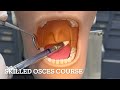 Inferior Alveolar Nerve Block Technique By Sarah Hussein