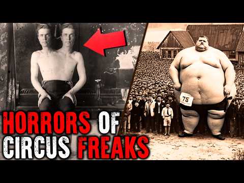 Circus Freaks That Actually Existed! Historical Photos