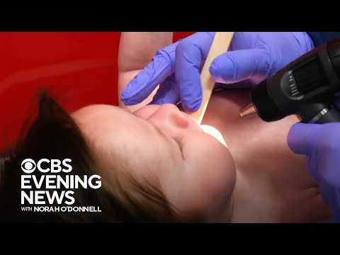 Supply of RSV antibody shot struggling to meet demand