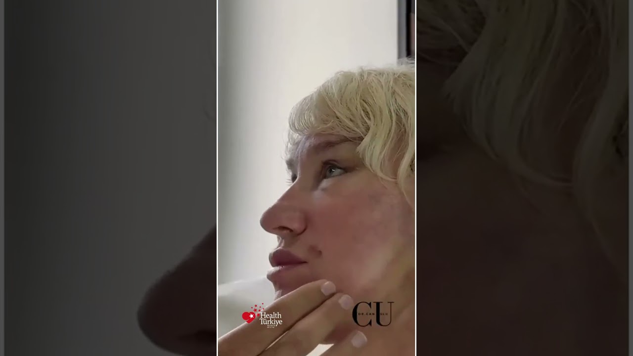 Facelift sonrasi masaj