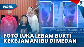 Foto Luka Lebam Jadi Bukti Kekejaman Ibu di Medan sebelum Dibunuh Siswa SD, 2 Jam Siksa Kakak