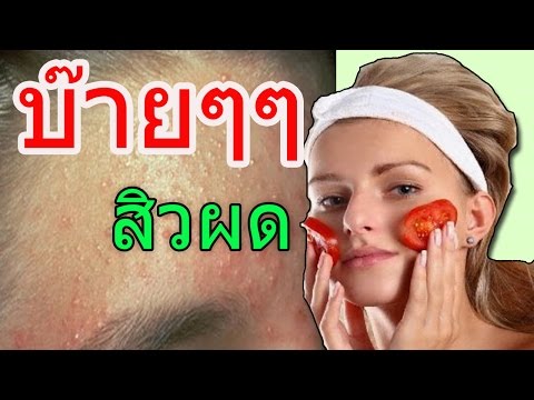 ฉันใน 18 ปีสามารถที่จะเพิ่มสมาชิก เป็น candidiasis ส่งผลกระทบต่อความแรง